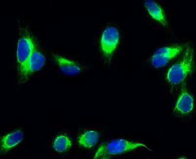 CYP19A1 rabbit pAb