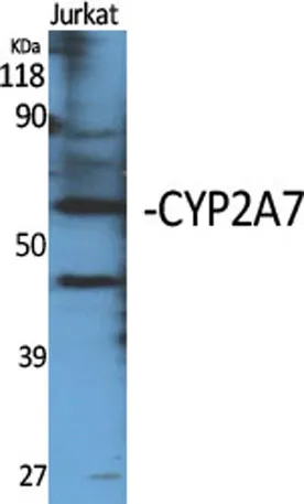 CYP2A7 rabbit pAb