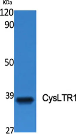 CysLTR1 rabbit pAb - image 1
