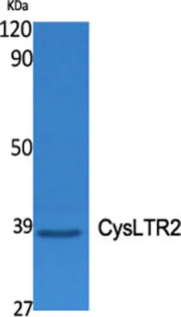 CysLTR2 rabbit pAb - image 1