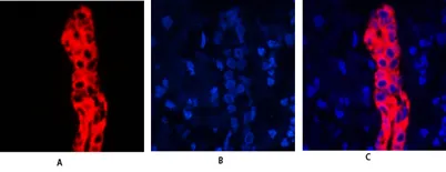 Cytokeratin 19 rabbit pAb