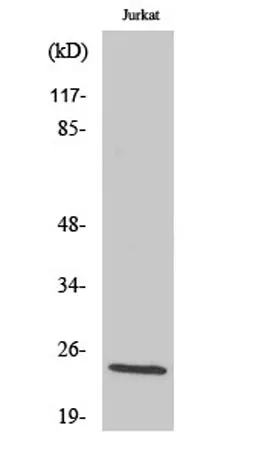 dTMP Kinase rabbit pAb - image 1