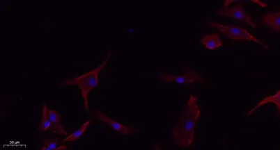 E-cadherin rabbit pAb - image 1