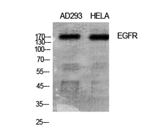 EGFR rabbit pAb - image 1