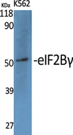 eIF2Bγ rabbit pAb - image 1