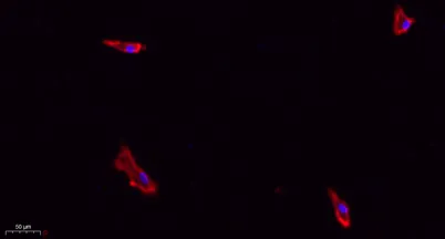 eIF2α rabbit pAb - image 1