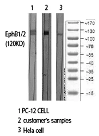 EphB1/2 rabbit pAb - image 1