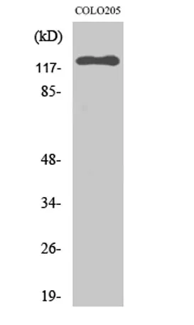 EphB6 rabbit pAb - image 1