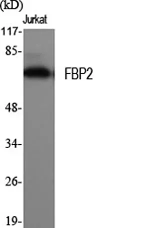 FBP2 rabbit pAb - image 1