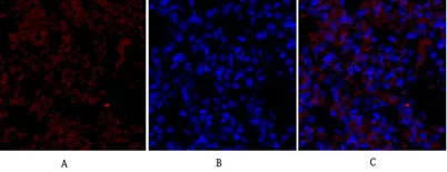 Flk-1/VEGFR2 rabbit pAb - image 1