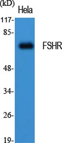 FSHR rabbit pAb - image 1