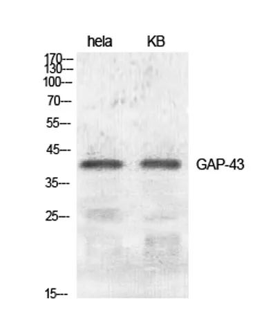 GAP-43 rabbit pAb