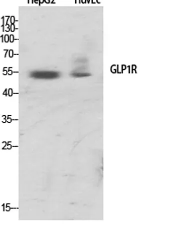 GLP-1R rabbit pAb - image 1