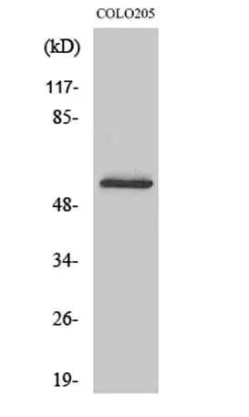 Glucagon Receptor rabbit pAb - image 1