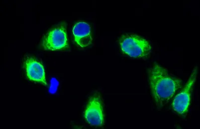 GluR-1 rabbit pAb - image 1