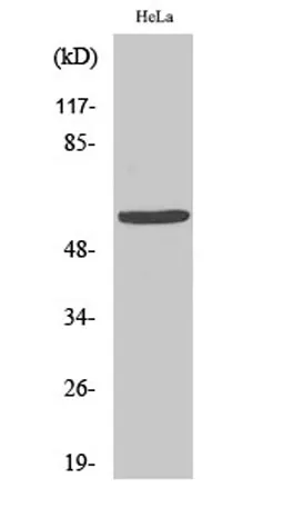 GM2/GD2 synthase rabbit pAb - image 1