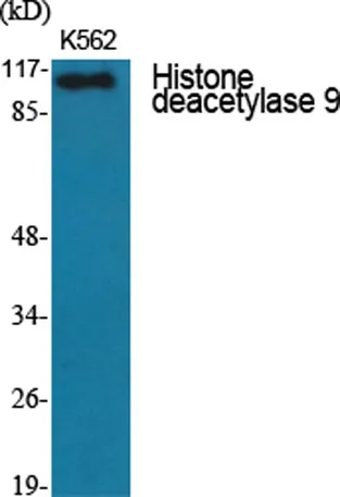 Histone deacetylase 9 rabbit pAb - image 1
