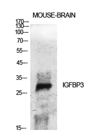 IGFBP3 rabbit pAb - image 1