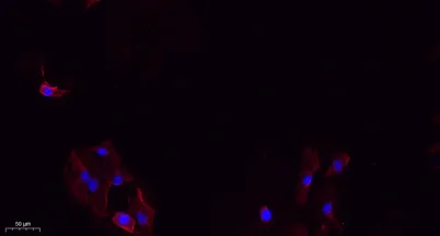 Integrin β3 rabbit pAb - image 1