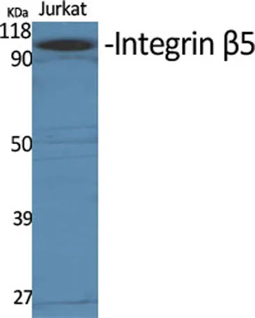 Integrin β5 rabbit pAb - image 1