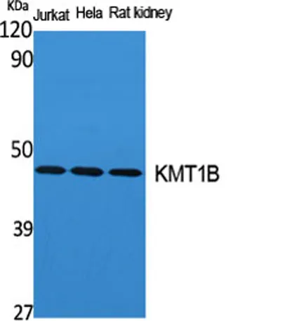 KMT1B rabbit pAb - image 1