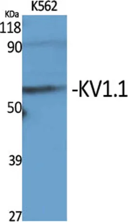 KV1.1 rabbit pAb - image 1