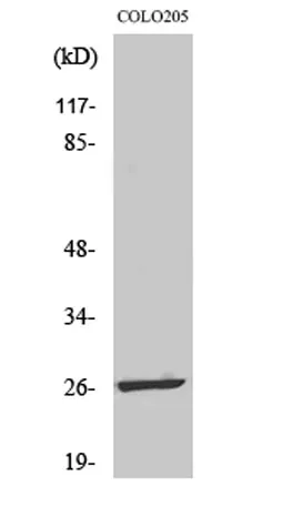 LDOC1L rabbit pAb - image 1