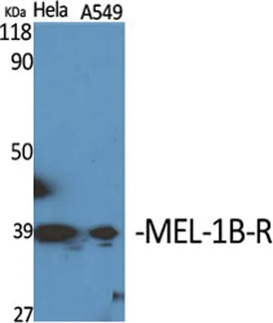 MEL-1B-R rabbit pAb - image 1