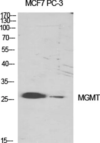 MGMT rabbit pAb - image 1