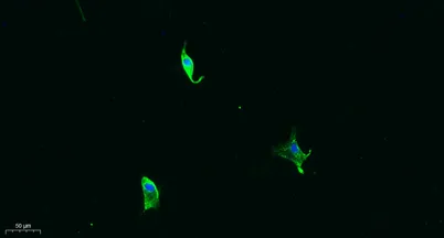 MMP-13 rabbit pAb - image 1