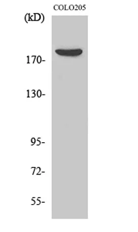 MRCKβ rabbit pAb - image 1