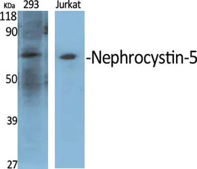 Nephrocystin-5 rabbit pAb - image 1