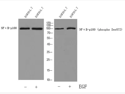 NFκB-p100 rabbit pAb - image 1