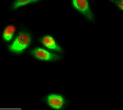 NFκB-p65 rabbit pAb - image 1