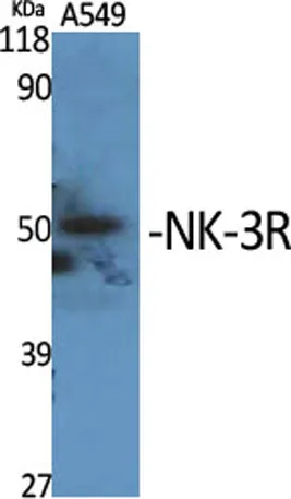 NK-3R rabbit pAb - image 1