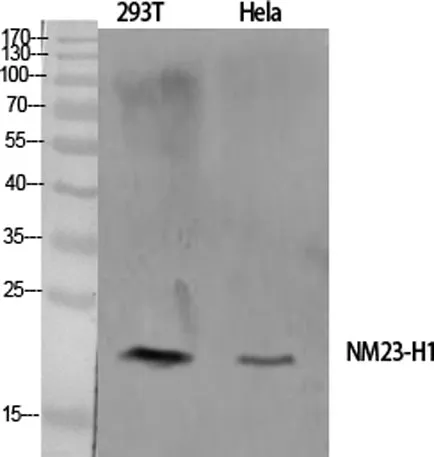 NM23-H1 rabbit pAb - image 1
