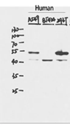 p53 Rabbit pAb - image 1