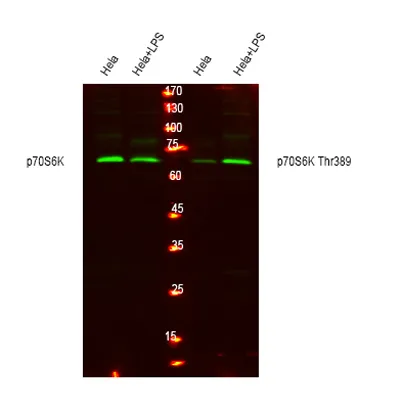 p70 S6 kinase α rabbit pAb - image 1