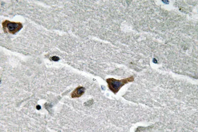 PAI-1 rabbit pAb - image 1
