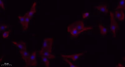 PDGFR-β rabbit pAb - image 1