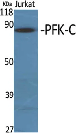 PFK-C rabbit pAb - image 1