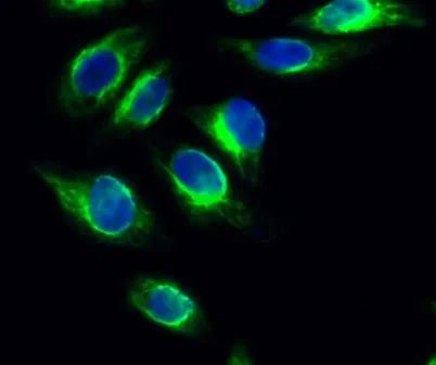 PKD1 rabbit pAb - image 1