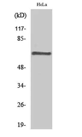 PP2A-Aβ rabbit pAb - image 1