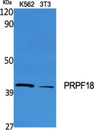 PRPF18 rabbit pAb