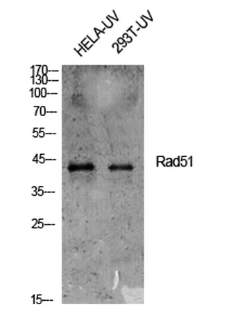 Rad51 rabbit pAb - image 1