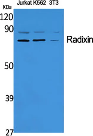 Radixin rabbit pAb - image 1