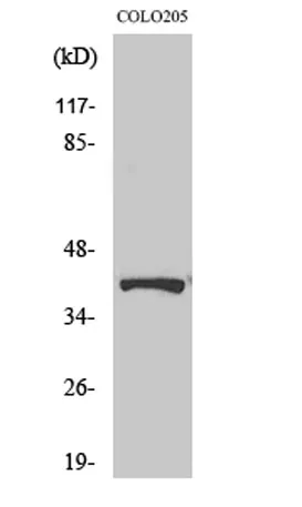 Renin Receptor rabbit pAb - image 1