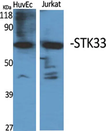 STK33 rabbit pAb - image 1