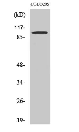 Synphilin-1 rabbit pAb - image 1