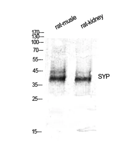SYP rabbit pAb